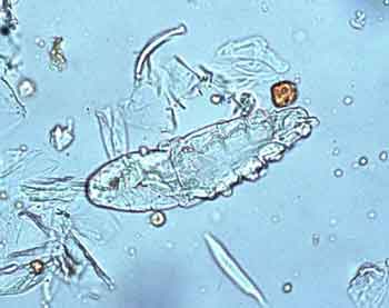 Demodex gatoi Фото