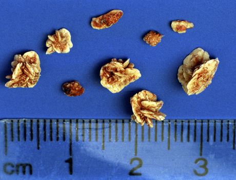 Мочекаменная болезнь у собак Фото