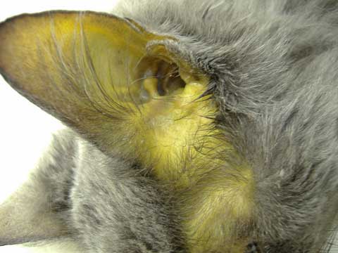 Лечение печени Фото