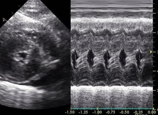 ГКМП (Гипертрофическая кардиомиопатия) кошек Фото