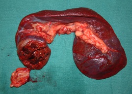 Опухоли селезенки у собак и кошек Фото