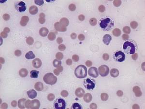 Общий анализ крови у собак Фото