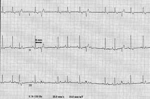 Аритмия у собак Фото
