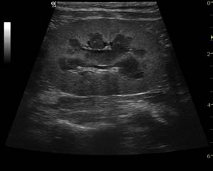 Болезни почек у собак Фото