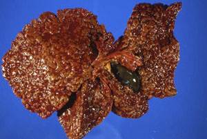 Цирроз и фиброз печени у собак Фото