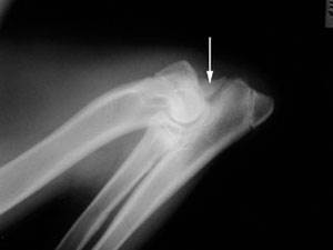 Дисплазия локтевого сустава у собак Фото