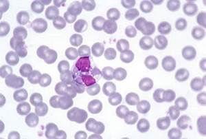 Эозинофилы у собаки Фото