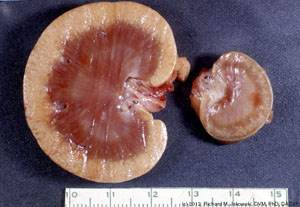 Гипоплазия, дисплазия и аплазия почки у собак Фото