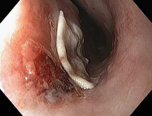 Инородное тело в пищеводе у собаки Фото