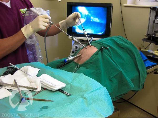 Лапароскопическая стерилизация Фото лапароскоп