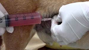 Лапароцентез Фото