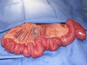 Линейное инородное тело Фото