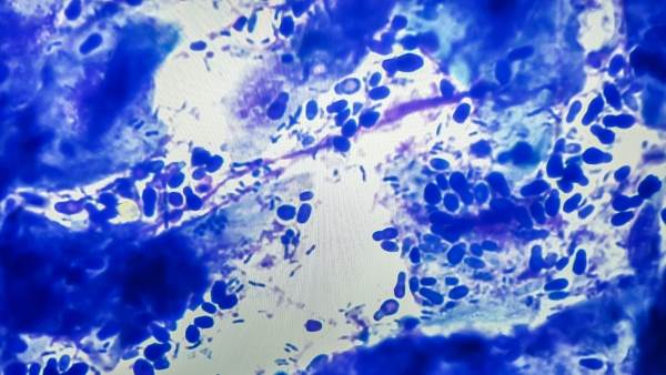 Грибок у кошек
Фото малассезии в микроскопе