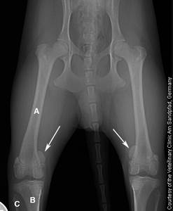 Диагностика вывиха коленной чашечки Фото