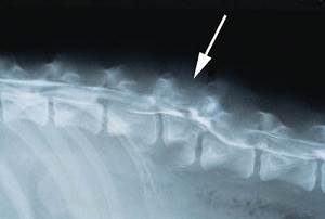 Разрушение спинного мозга
Фото