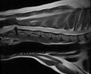 Разрушение спинного мозга
Фото