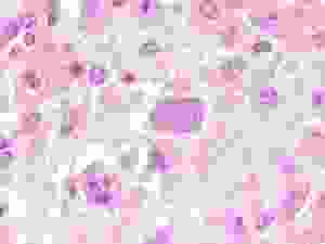 Neospora_caninum_bradyzoites
Фото