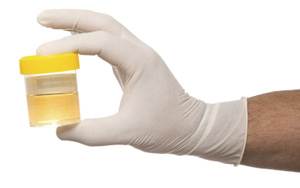 Общий анализ мочи Фото