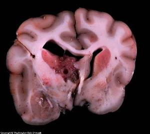 Опухоли головного мозга у собак Фото