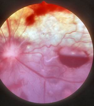 Отслойка сетчатки у собак Фото