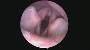 Паралич гортани у собак Фото