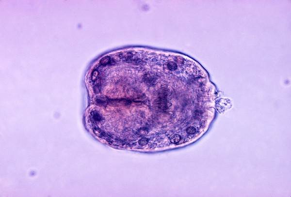 Эхинококкоз Фото альвеококкоз