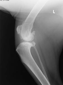 Разрыв передней крестовидной связки Фото