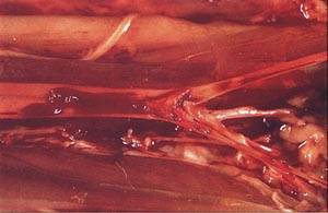 Тромбоэмболия у кошек Фото